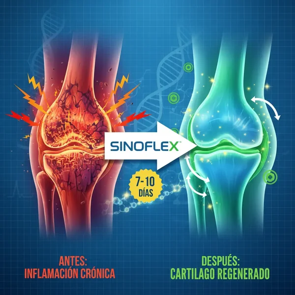 Comparación antes y después: Articulación inflamada vs cartílago regenerado con Sinoflex en 7-10 días